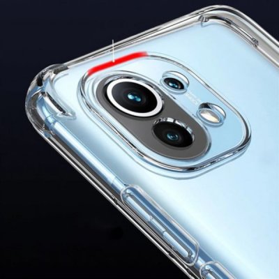 Xiaomi Mi 11 Silikonskal Transparent